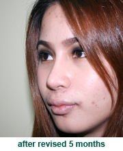 plastic_surgery_augmentation_rhinoplasty